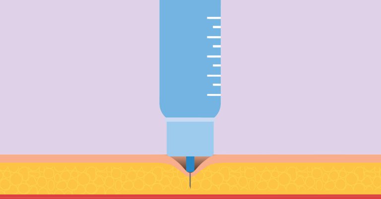 15 tips injecteren insuline met de pen