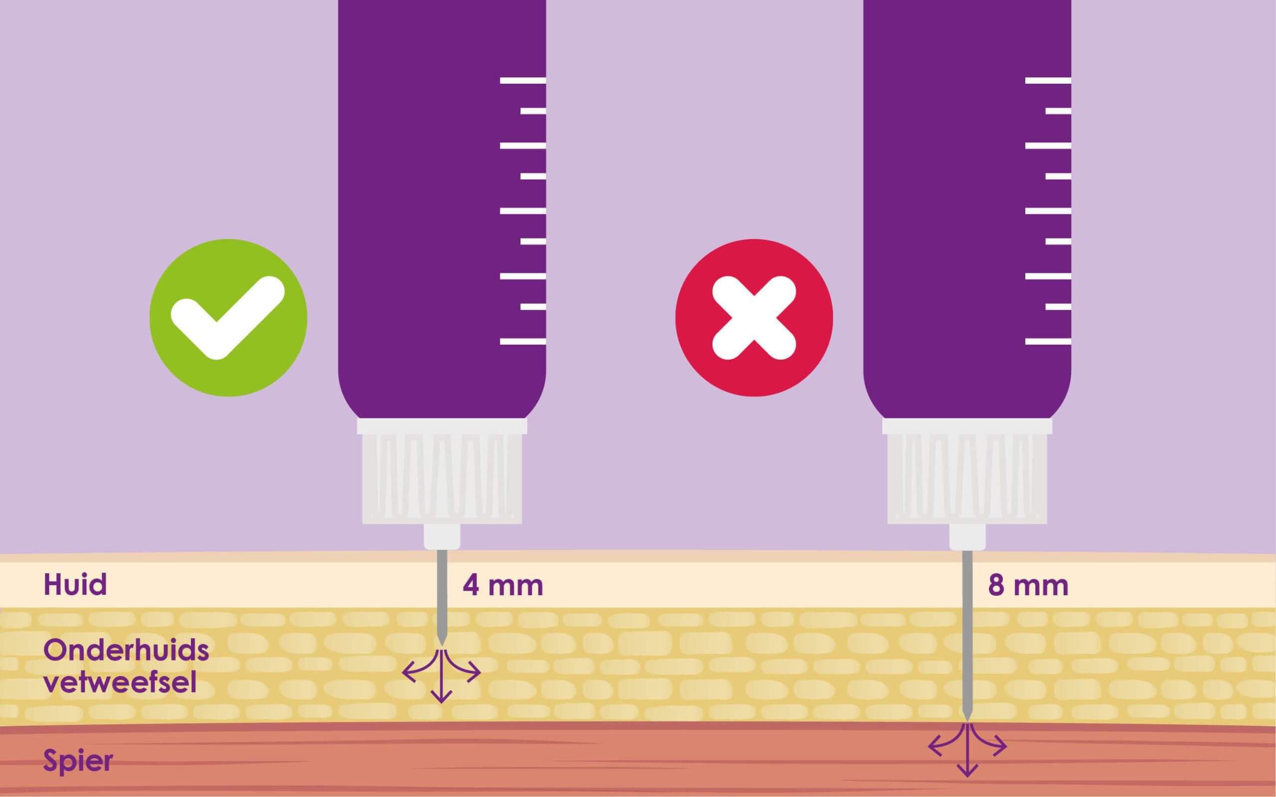 Insuline injectie in spier vermijden